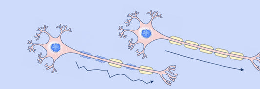 Esclerosis Múltiple y Cannabis